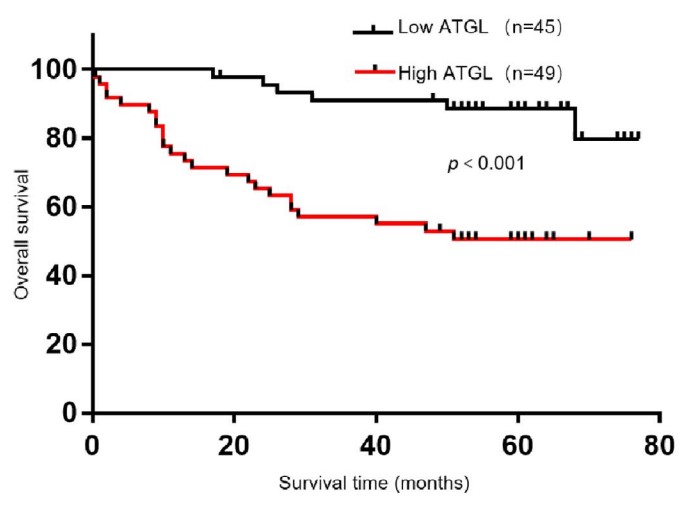 Overall survival of CRC patients in CRC Tissue Microarray with low and high ATGL expression.jpg
